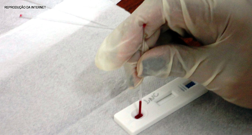 “Não falta kits para testes rápidos para diagnóstico de dengue nos hospitais do DF”, afirma Secretário de Saúde