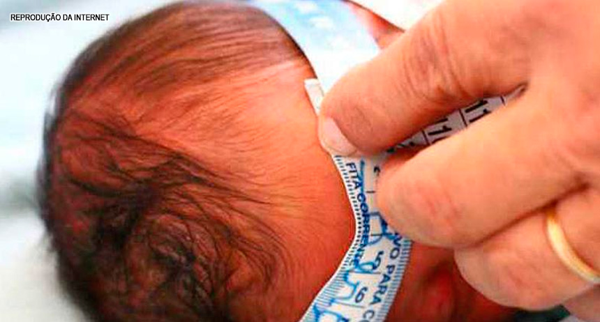 Ministério da Saúde descarta relação de larvicida pyriproxifen com a microcefalia