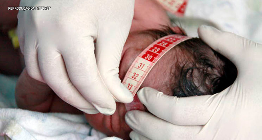 Governo federal paga R$ 2,2 mil para acelerar identificação e diagnóstico de microcefalia