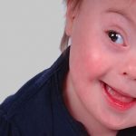 sindrome down
