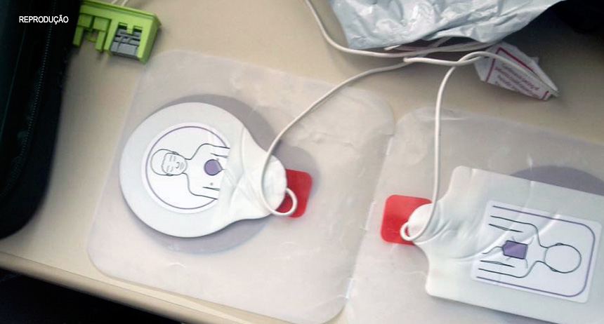 SAMU-DF está ‘socorrendo’ pacientes com desfibrilador vencido e até reutilizado?