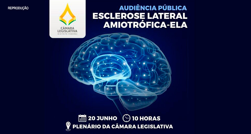 Esclerose Lateral Amiotrófica é tema de audiência pública na Câmara Legislativa do DF, nesta segunda (20)