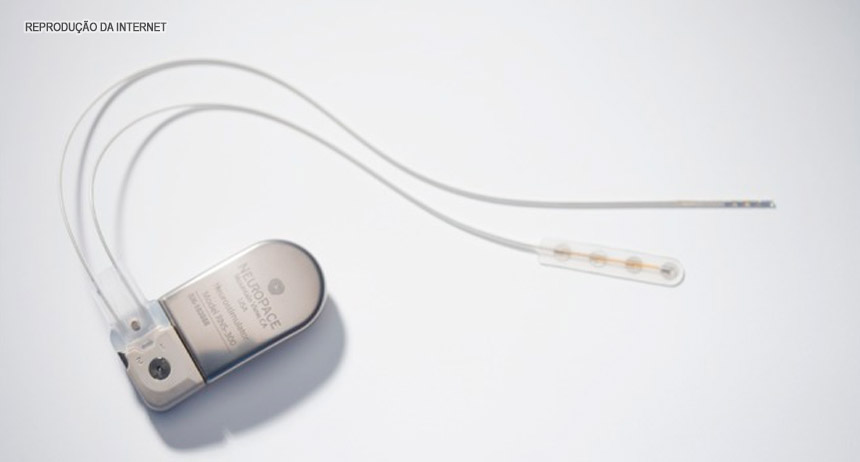 Quadrilha monta esquema ilegal para compra de marca-passo em SP