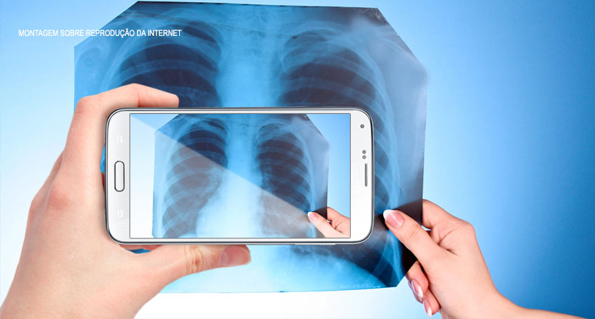 “Os médicos têm que interpretar o Raio X, na tela de celular do paciente”, afirma o presidente do SindMédico-DF sobre o Hospital do Paranoá