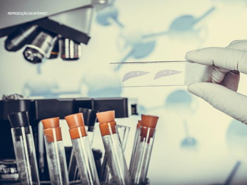 Ministério da Saúde amplia faixa etária de transplante para doença falciforme