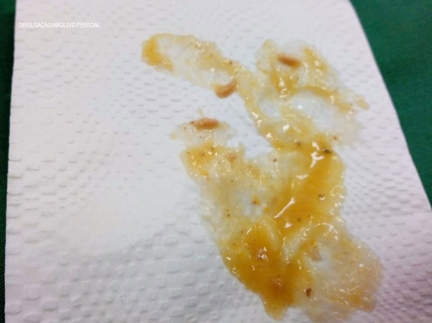 Depois de “restos de comida”, servidor do HRG denuncia ter encontrado larvas em refeição