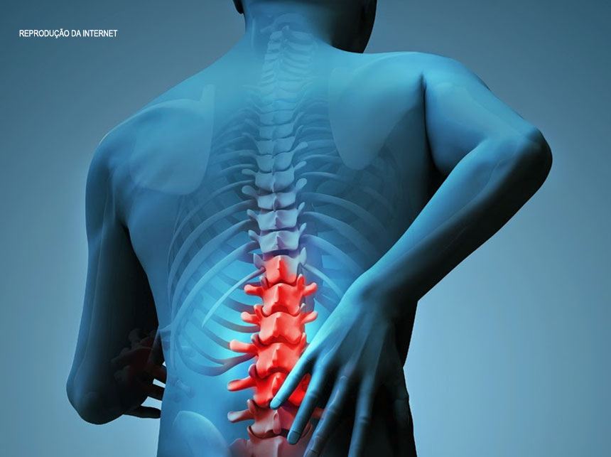 Utilidade Pública: Grupo de Fisioterapia da UnB oferece intervenção gratuita à pessoas com dores lombares