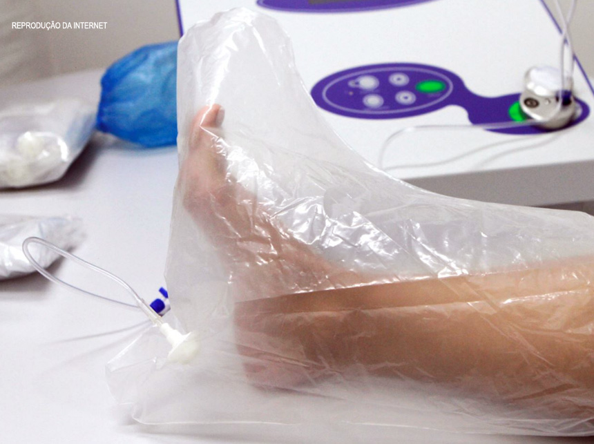 Defensoria pede indenização para paciente que teve a perna amputada após tratamento médico experimental irregular