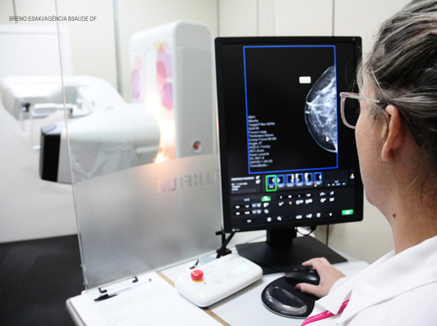 Hospitais do DF recebem cinco novos mamógrafos digitais