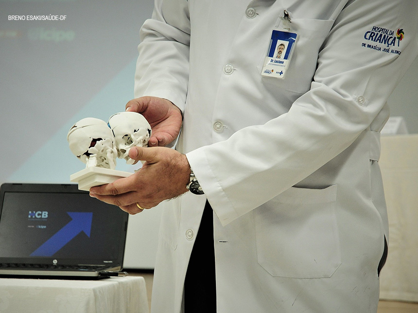 Médicos realizam cirurgia inédita no DF e separam gêmeas siamesas ligadas pelo crânio