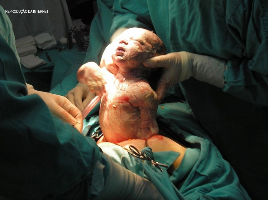 Saúde: DF e GO buscam atuação em rede para melhorar atendimento a gestantes