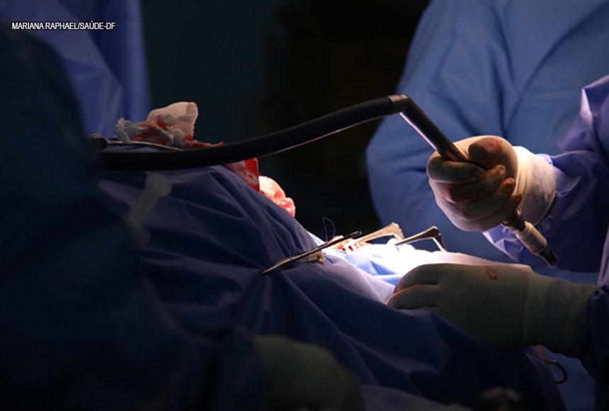 cirurgias ses