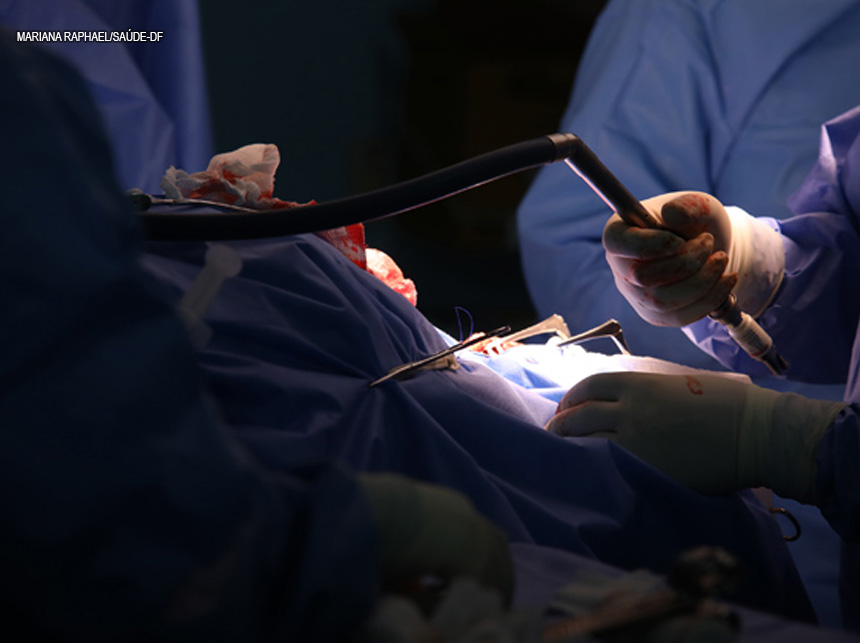 Rede pública de saúde realiza 27,3 mil cirurgias em 150 dias no DF