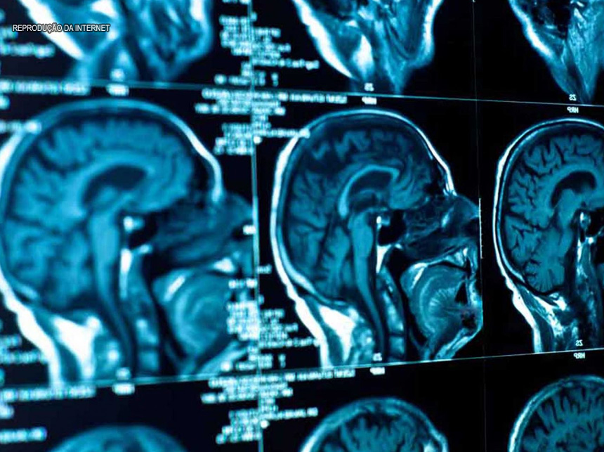 Pesquisa: vírus Zika traz prejuízos motores e de memória a adultos