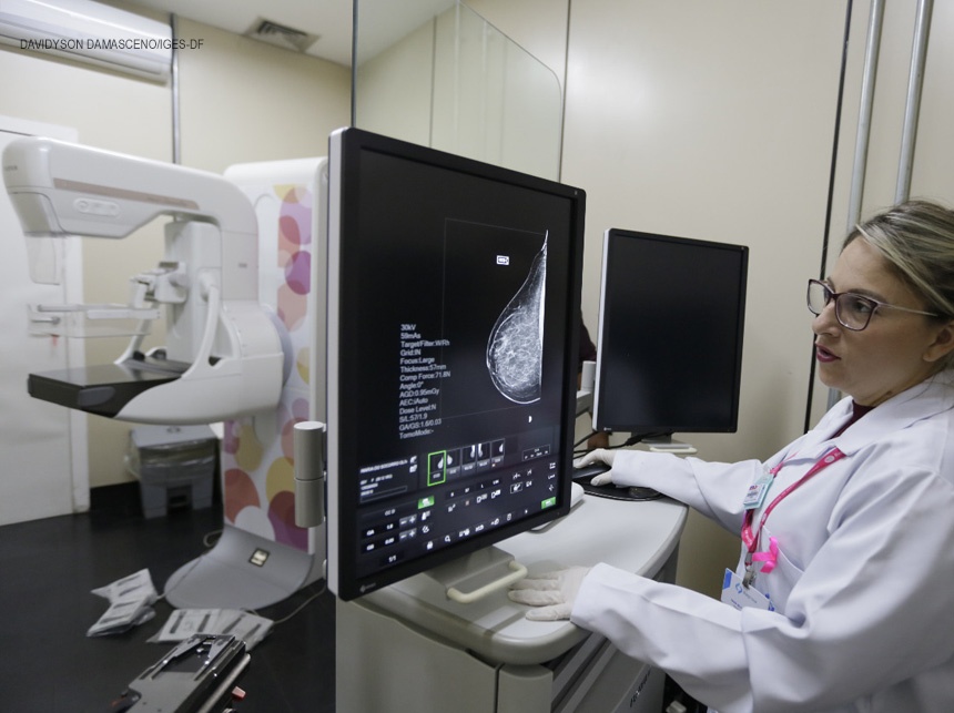 IGESDF realiza 30 mil exames radiológicos por mês