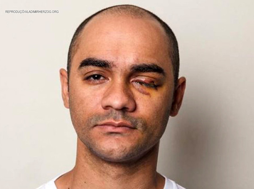 Ato no STF cobra justiça para jornalista vítima de violência policial