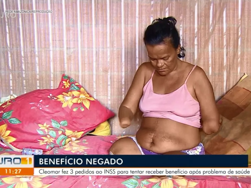 Mulher sem mãos e pernas tem pedido de benefício negado pelo INSS por não poder assinar papel, em RO