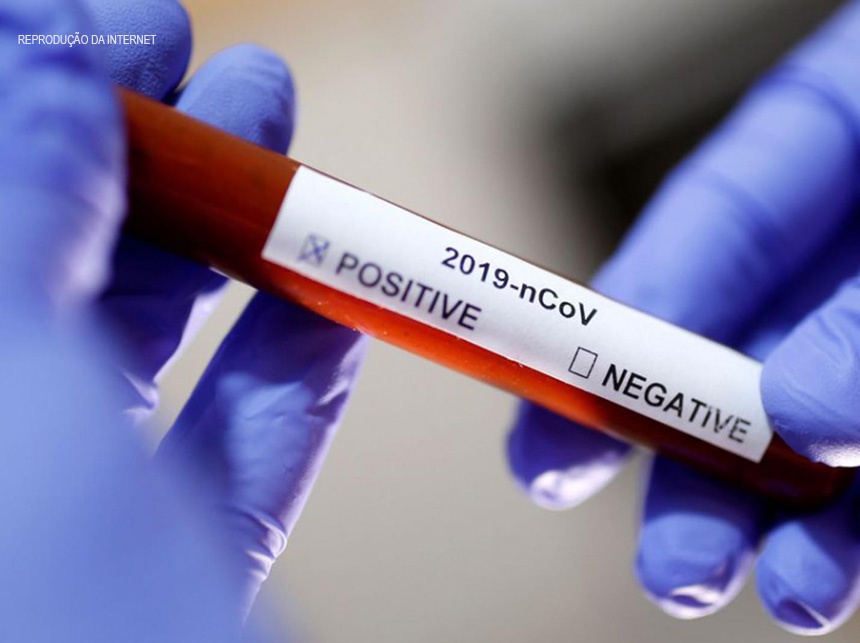 Covid-19: DF registra 14 novos casos da doença