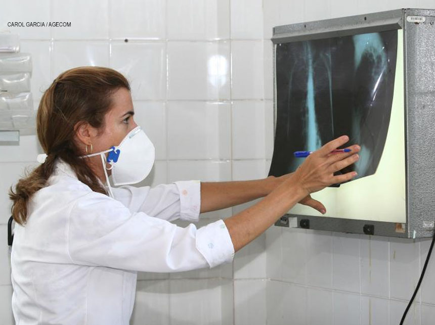Coronavírus: quem tem tuberculose deve redobrar os cuidados