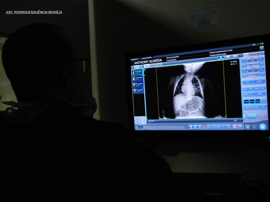 Encaixotado há cinco anos, aparelho de raios X vai dobrar atendimento em Brazlândia