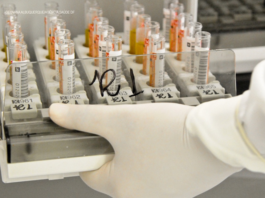 HRAN começa a aplicar plasma de curados da Covid-19 em pacientes internados