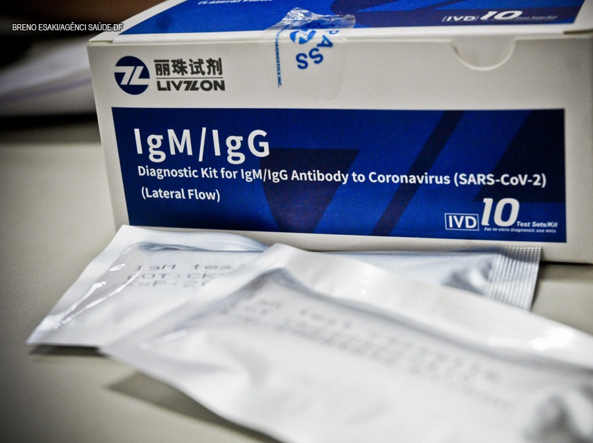 Secretaria de Saúde do DF abre pregão para compra de 1 milhão de testes rápidos