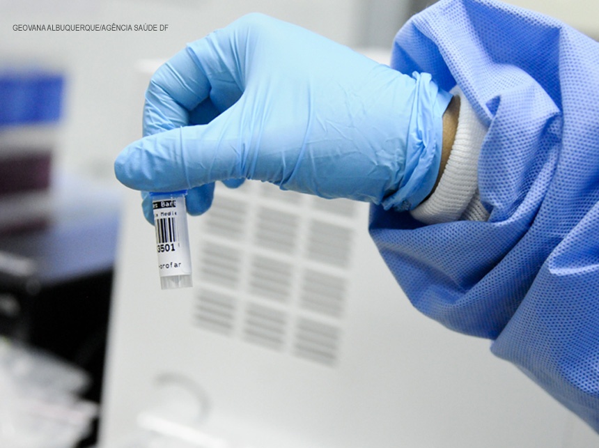 Lacen-DF cria novo protocolo para realizar exames de detecção da Covid-19