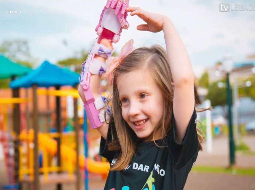 Projeto de Lei institui o dia da Conscientização da Agenesia de Membros