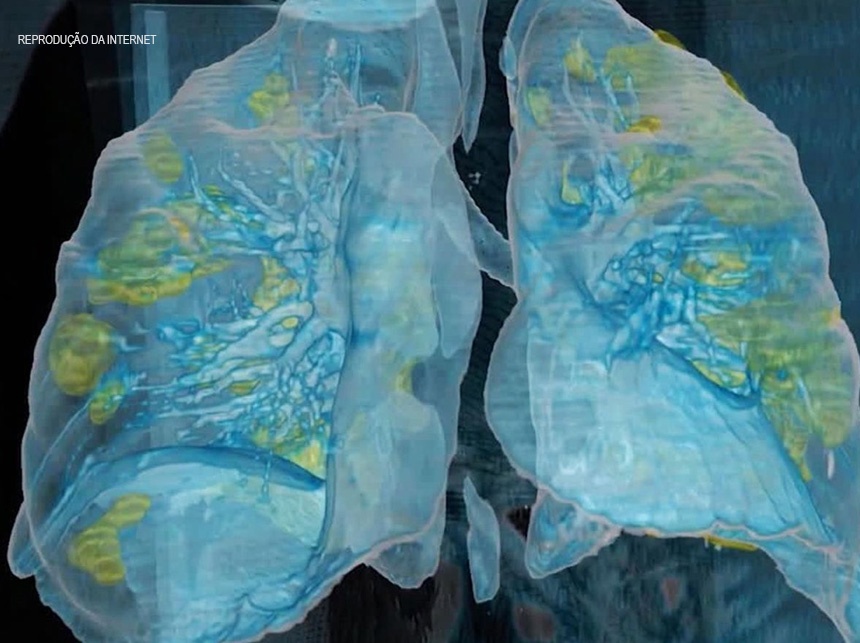 Covid-19: Brasil tem 67,9 mil mortes e 1 milhão de curados