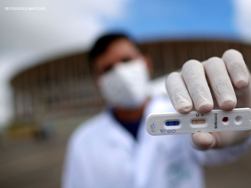 Anvisa aprova primeira marca de autoteste do Brasil