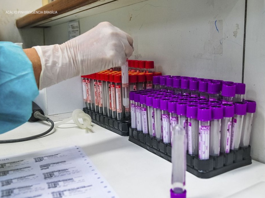 Covid-19: UFRJ desenvolve teste sorológico 20 vezes mais barato