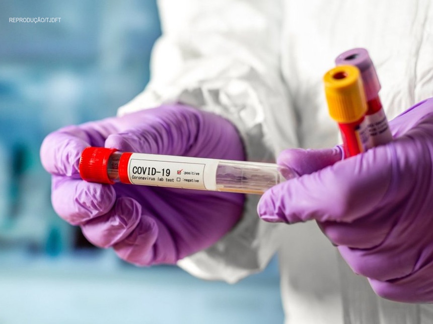 Covid-19: mudança na interpretação de exame não gera dever de indenização