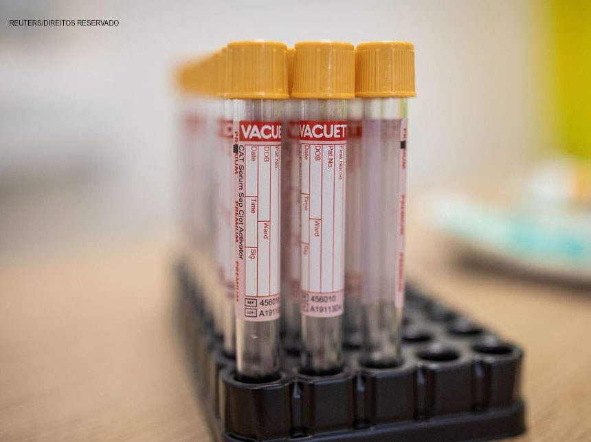 Covid-19: DF registra cinco novas mortes e chega a 3.930 óbitos pela doença