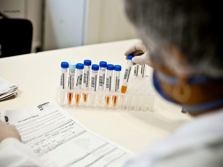 Lacen-DF registra queda de 43% em exames para Covid