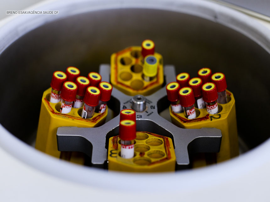 Saúde aproveita mais de 88% dos testes doados com vencimento em apenas 82 dias