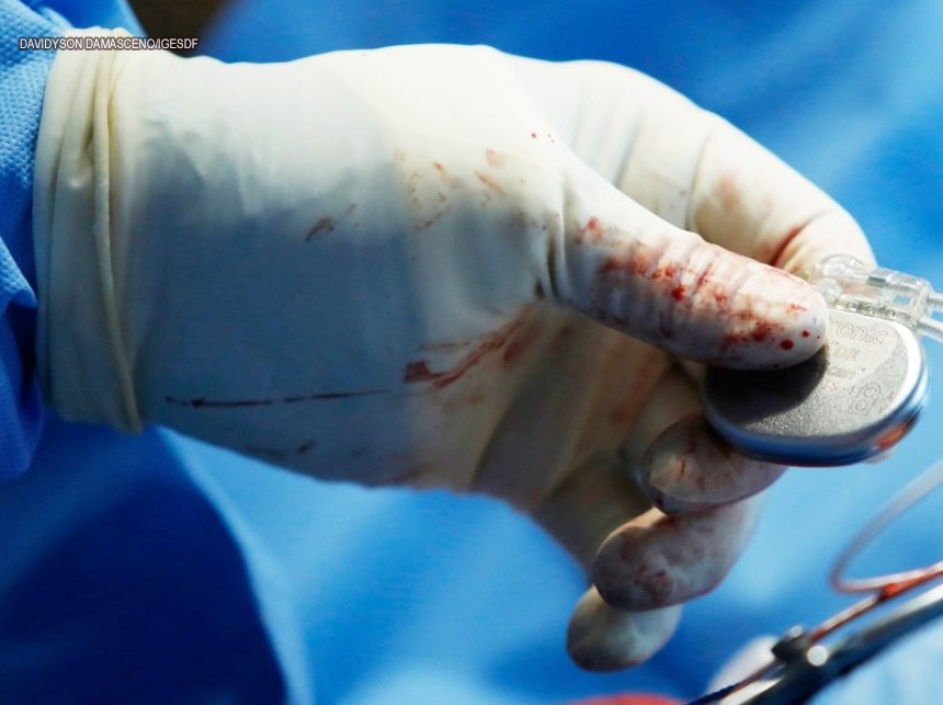 HBDF zera fila de pacientes de marca-passo