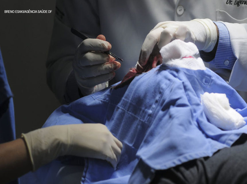 Governo federal inicia medidas para diminuir espera por cirurgias e atendimentos especializados no SUS