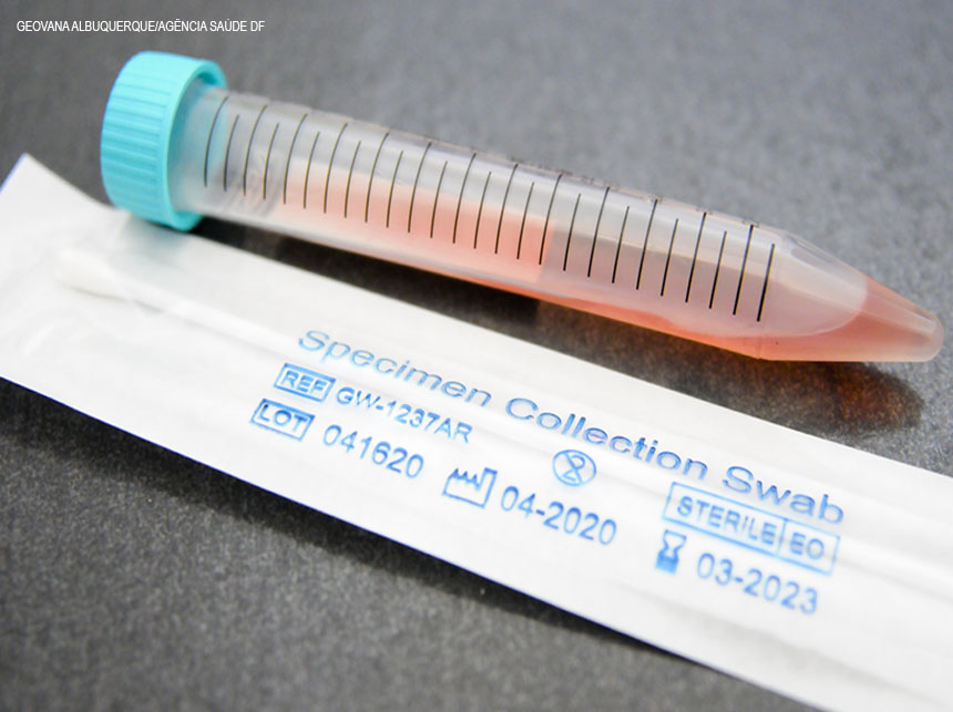 Saúde do DF orienta população a procurar UBS em casos de sintomas da Covid-19