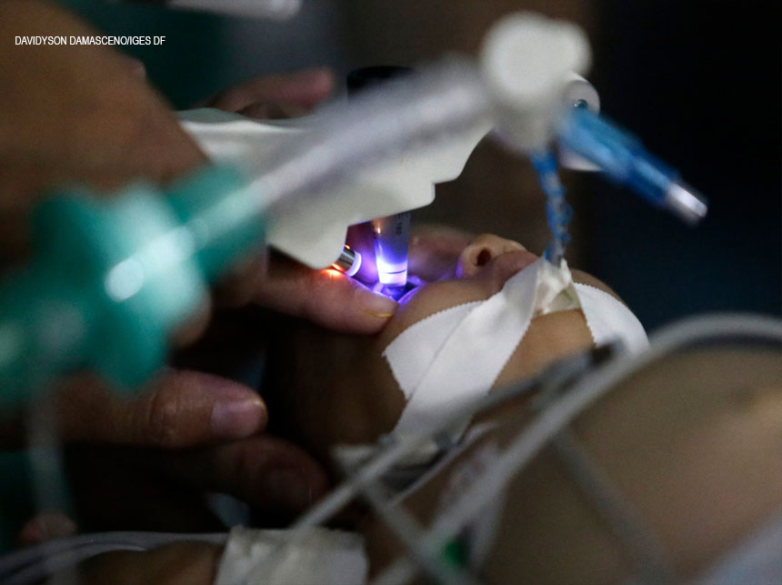 Equipe do Hospital de Base realiza cirurgia oftalmológica em gêmeas recém-nascidas