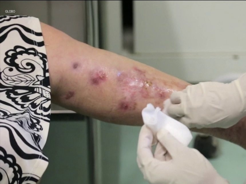 Doença infecciosa transmitida por gatos é confirmada em Manaus