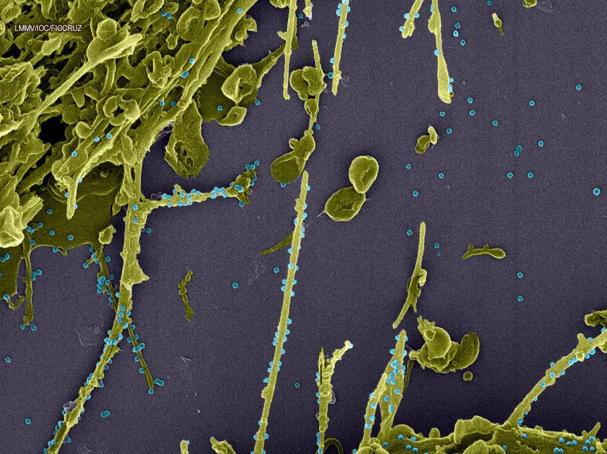 Adolfo Lutz divulga segunda-feira análise de variante do coronavírus