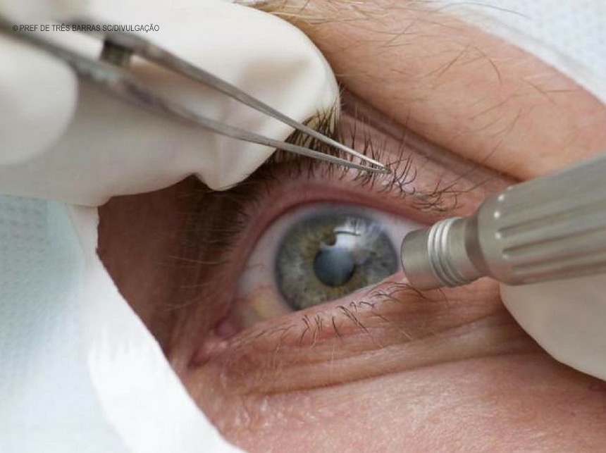 Pandemia faz cair detecção precoce de glaucoma