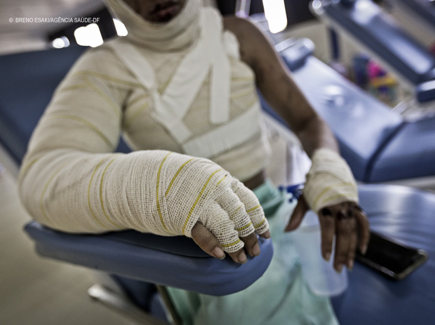 Junho Laranja alerta para a prevenção a queimaduras