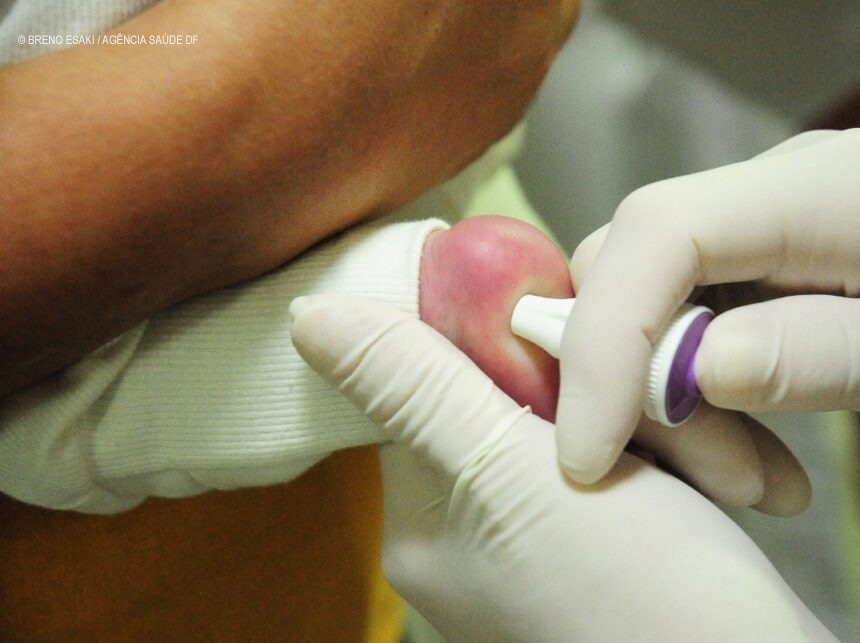 Teste do pezinho feito no DF é o mais completo do país