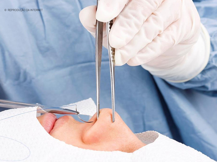 Plano de saúde cobre cirurgia plástica?