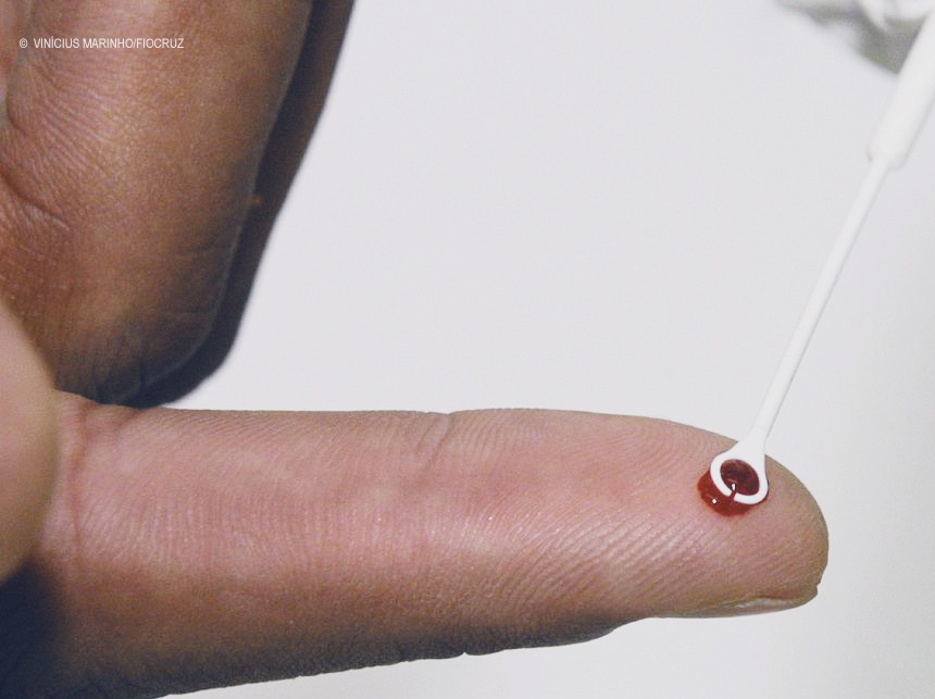 HIV: estudo mostra resistência de mutação a remédio usado no Brasil