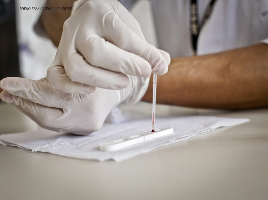 Prevenção ao HIV deve ser feita durante todo o ano