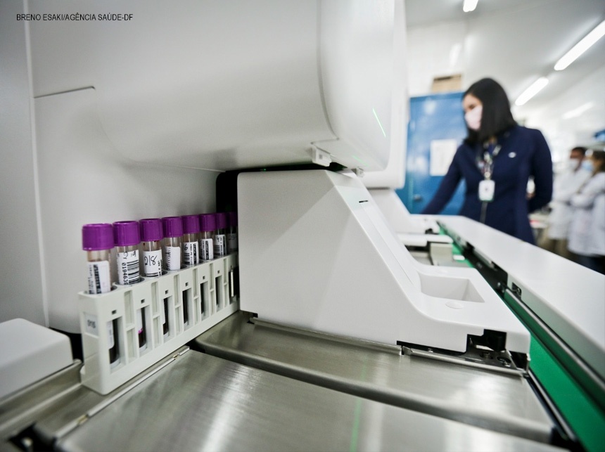 Laboratório de Ceilândia amplia capacidade de análise de exames