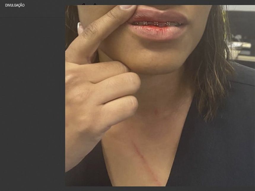 Enfermeira é agredida por acompanhante de paciente na UPA do Recanto das Emas