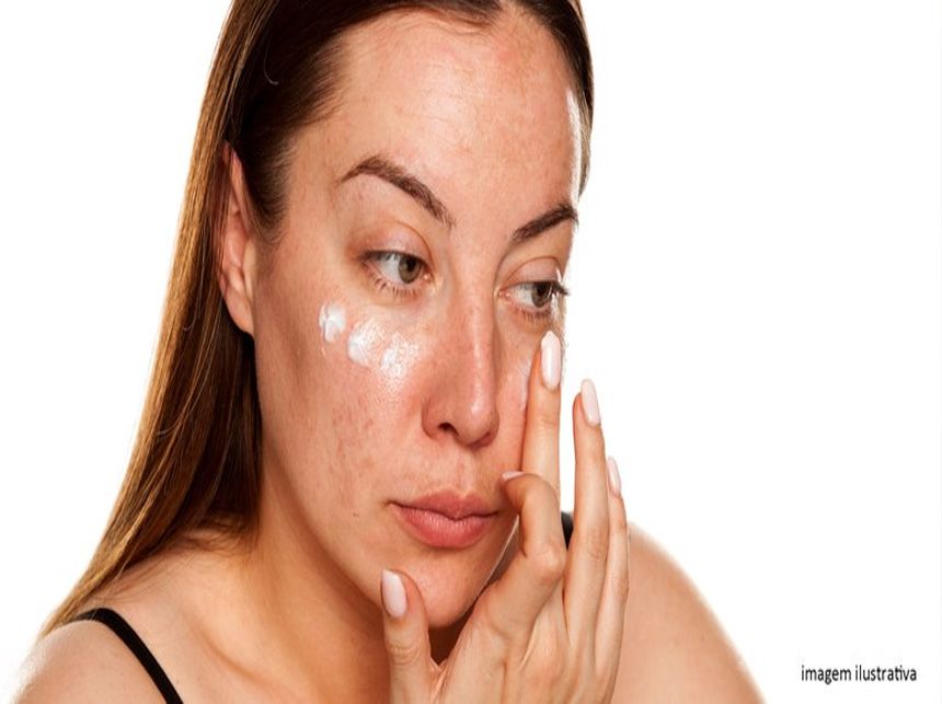 Consumidora que sofreu queimadura em procedimento estético deve ser indenizada